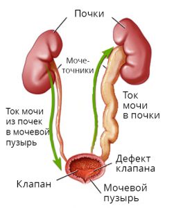 nefropatija_RU