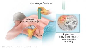 biopsija