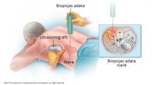 biopsija